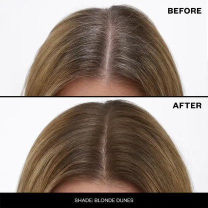 Flawless Roots. No Gaps. Never Miss - Buy 1 Get 1 Free