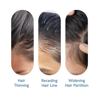 Bodywise Advanced | Science-Backed & Clinically Proven Follicle Activation