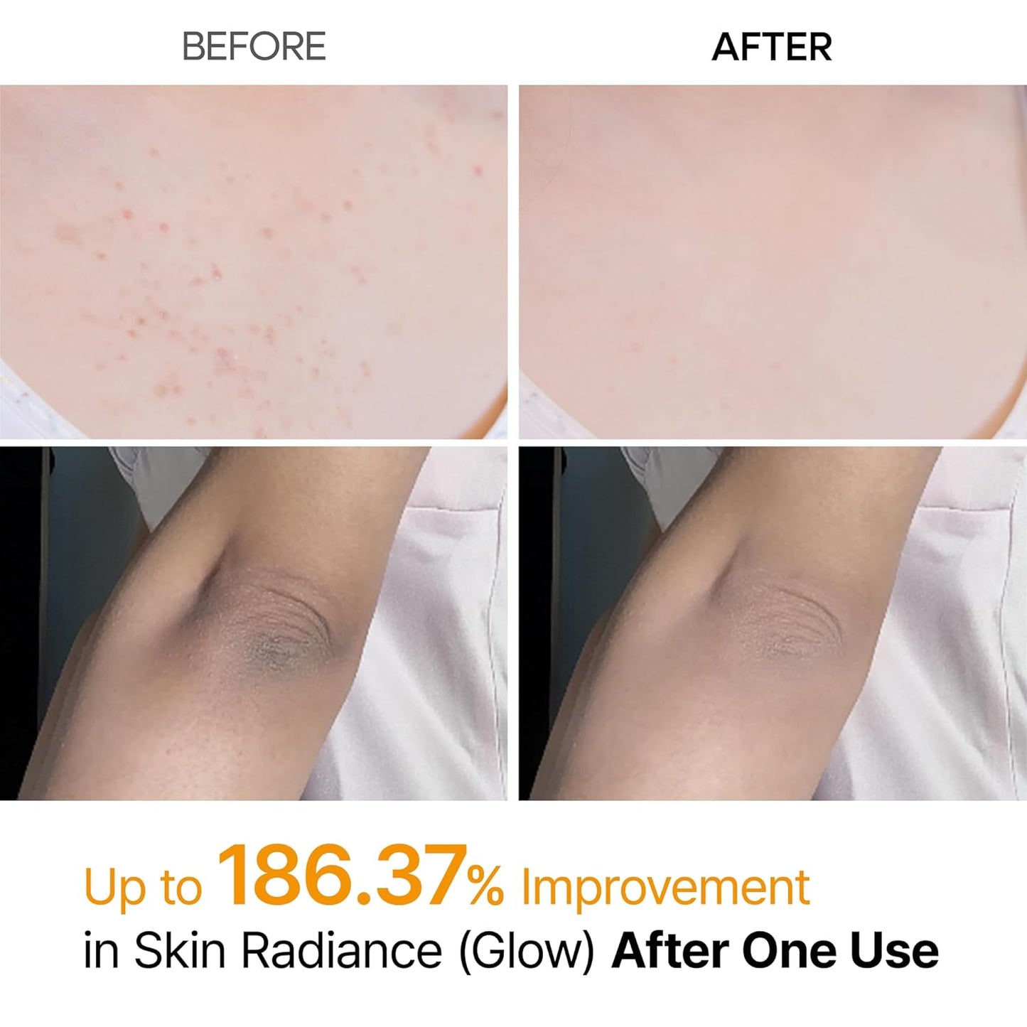 Get "Glass Skin" from Head to Toe: The Professional Peel in a Spray
