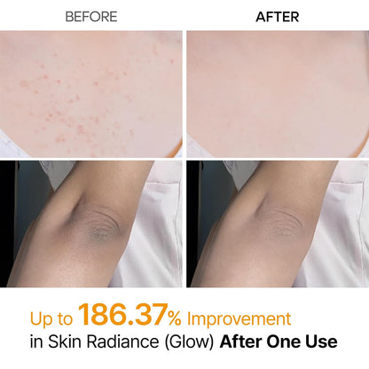 Get "Glass Skin" from Head to Toe: The Professional Peel in a Spray