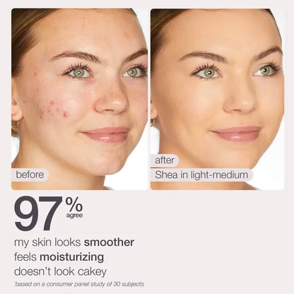 Skincare Meets Perfection