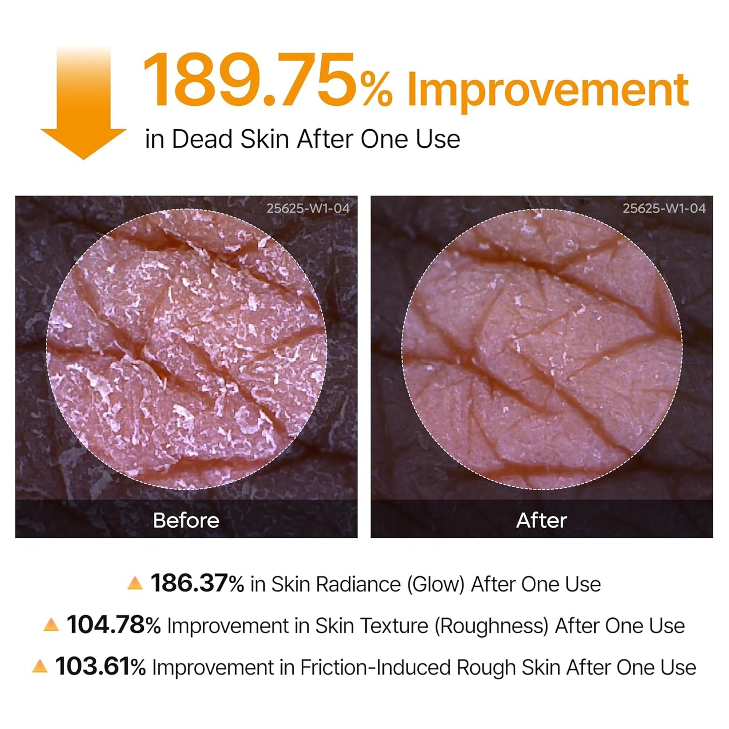 Get "Glass Skin" from Head to Toe: The Professional Peel in a Spray