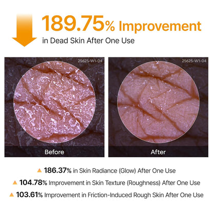 Get "Glass Skin" from Head to Toe: The Professional Peel in a Spray